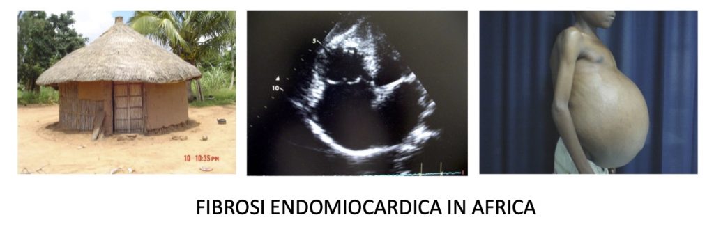 Diverse Cardiomiopatie