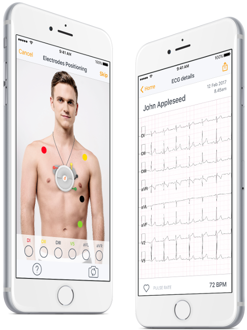 Tracciato Ecg Smartphone